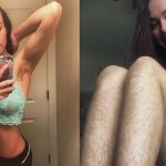 jambes-poilues